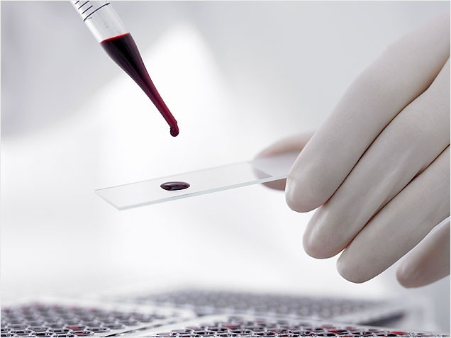 Анализ крови: расшифровка и норма
