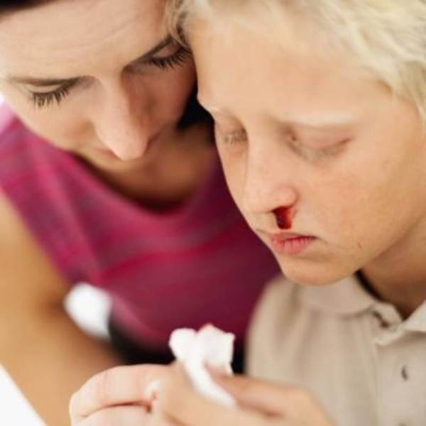 Кровь из носа: причины