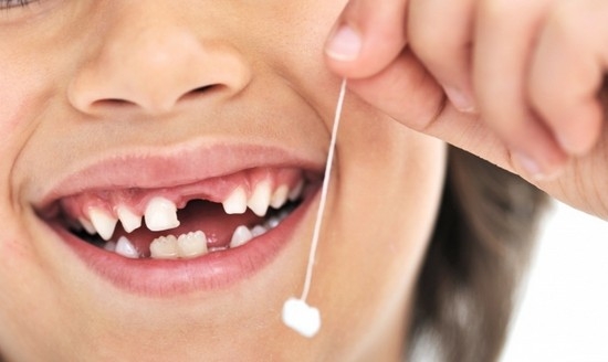 В каком порядке меняются молочные зубы