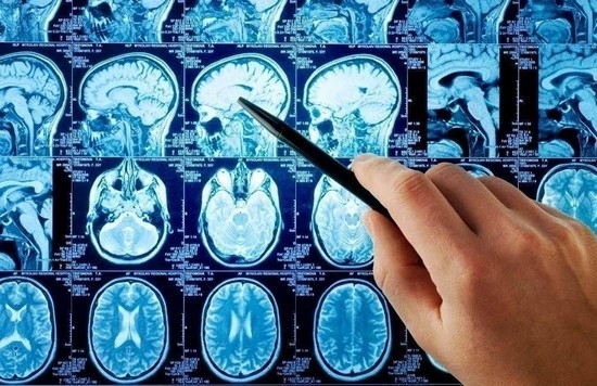 Что лучше - МРТ или КТ сосудов головного мозга и шеи