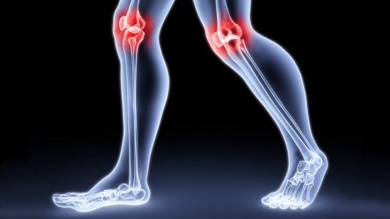 Как «разоблачить» артроз коленного сустава