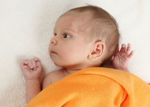 Что делать, если на лице новорожденного появилась сыпь?