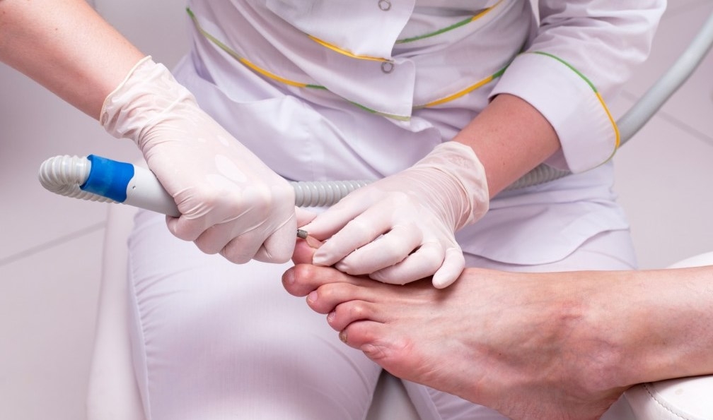 Вросший ноготь на большом пальце ноги: лечение медицинскими способами