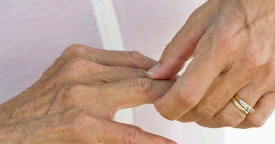Ревматоидный артрит пальцев рук: первые симптомы