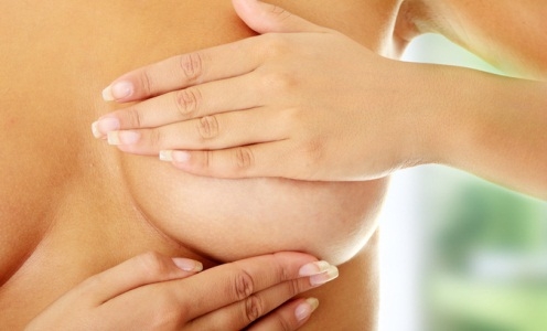 растяжки на груди при беременности
