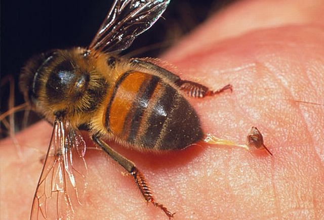 Укус пчелы: последствия