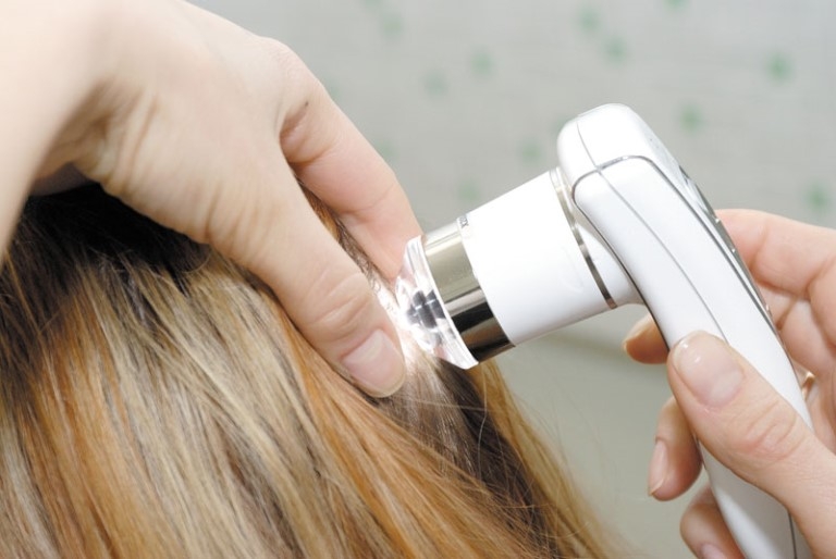 Причины выпадения волос. Способы лечения и отзывы