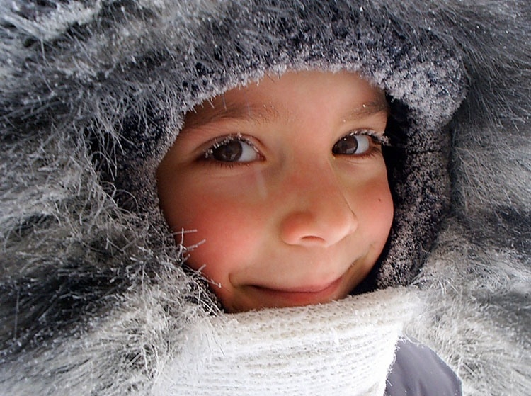 Обморожение щеки у ребенка: что делать?