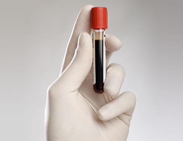 Анализ крови: расшифровка и норма