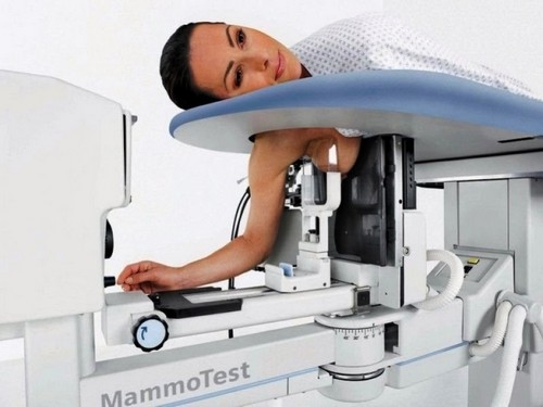 маммография молочной железы