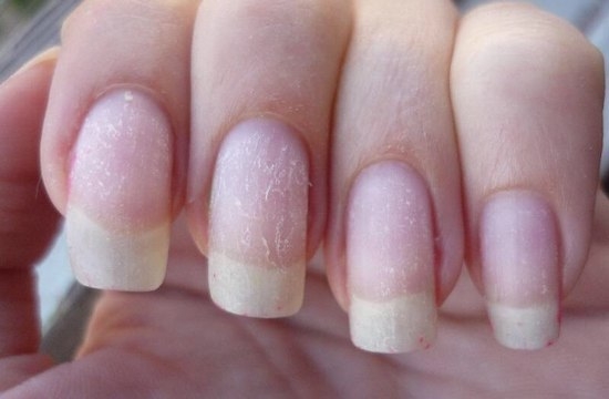 Как реанимировать ногти после снятия гель-лака?