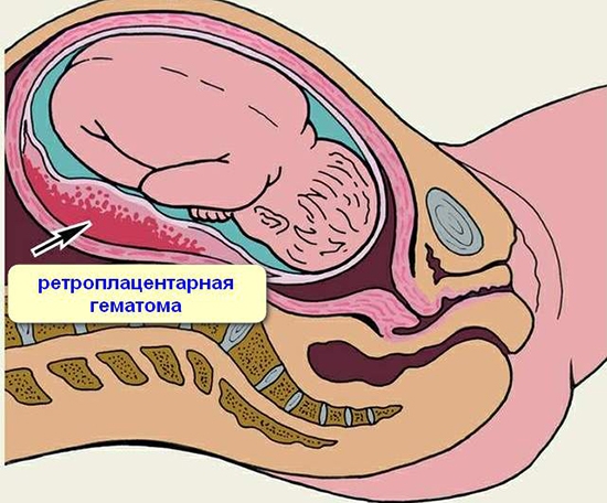 Плацента – место, где находится и развивается зародыш