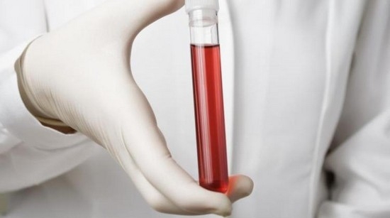 Гематологический анализ крови: расшифровка
