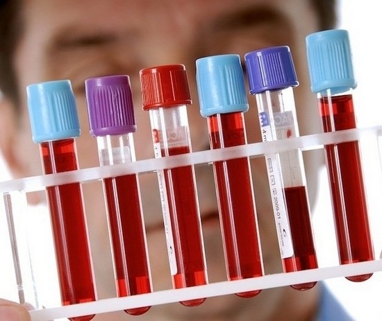Анализ крови в диагностике лейкоза у взрослых
