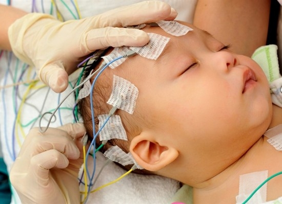 Электроэнцефалографию мозга выполняют даже младенцам