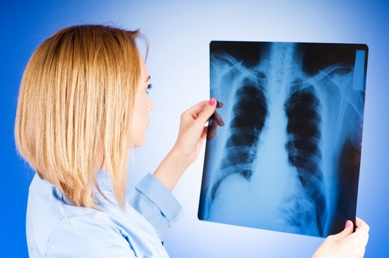 Симптомы туберкулеза легких у женщин на ранней стадии