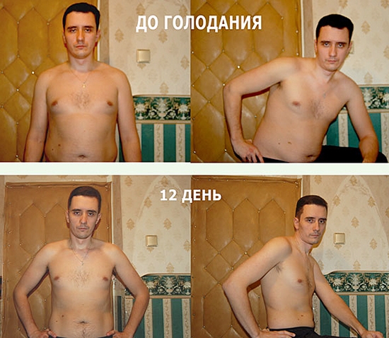 Помогает ли голод. Голодание. Голодание до и после. Тело до и после голодовки. Фото после голодания.