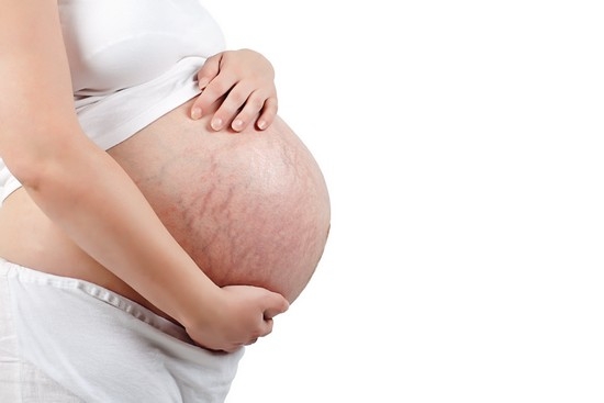 средства от растяжек во время беременности