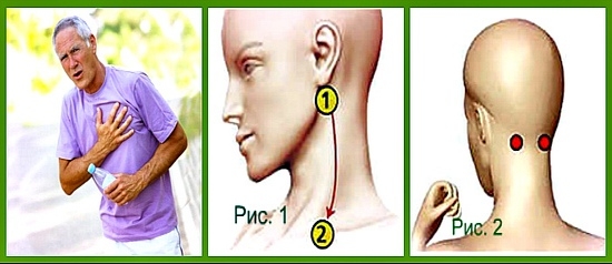 Если скачет давление и под рукой нет лекарств, то попробуйте сделать массаж акупунктурных точек, которые находятся под ушной мочкой