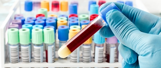 ИФА - расшифровка анализа крови